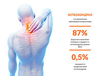 Остеохондроз поясничного отдела позвоночника симптомы и лечение
