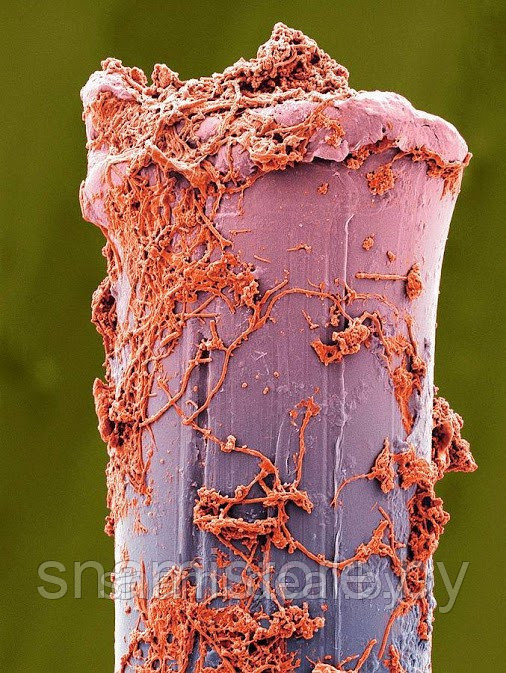 Щетина зубной щетки под микроскопом.