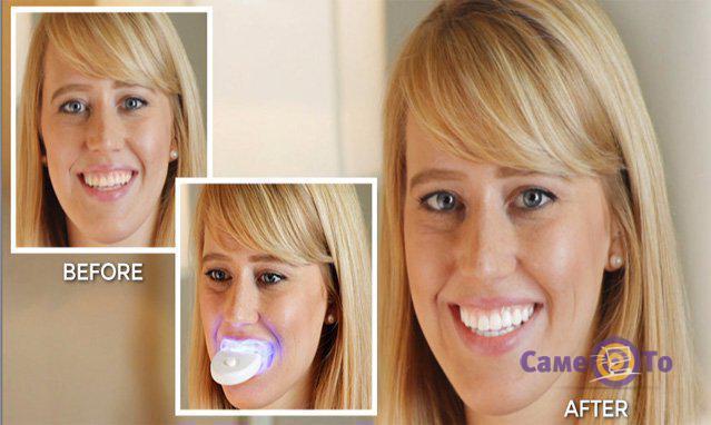 Система для отбеливания зубов 20 Minute Dental White - фото 3 - id-p84678154