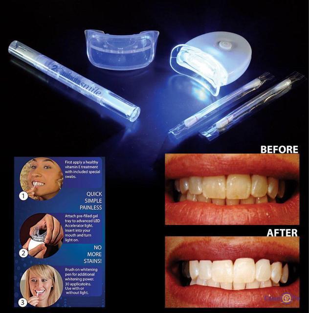 Система для отбеливания зубов 20 Minute Dental White - фото 4 - id-p84678154