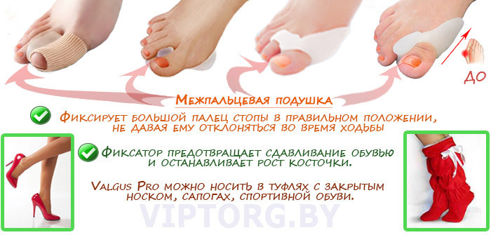 Разделитель от косточки на ноге Valgus Pro Comfort - фото 4 - id-p88127603