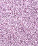 Жидкие обои BioPlast ( Биопласт ) 611, фото 2