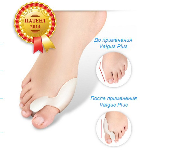 Фиксатор силиконовый от косточки на ноге Valgus Pro 2 штуки - фото 7 - id-p91001890