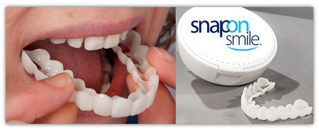 Накладные зубы Snap on Smile - Съемные виниры - фото 10 - id-p91221519