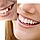 Набор для быстрой замены зуба Instant Smile Temporary Tooth Kit, фото 5
