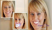 Отбеливатель зубов 20 Minute Dental White, фото 2