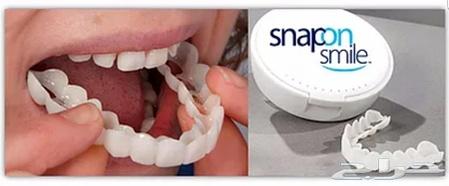 Накладные зубы - протезы для зубов Snap on smile верхние, фото 2