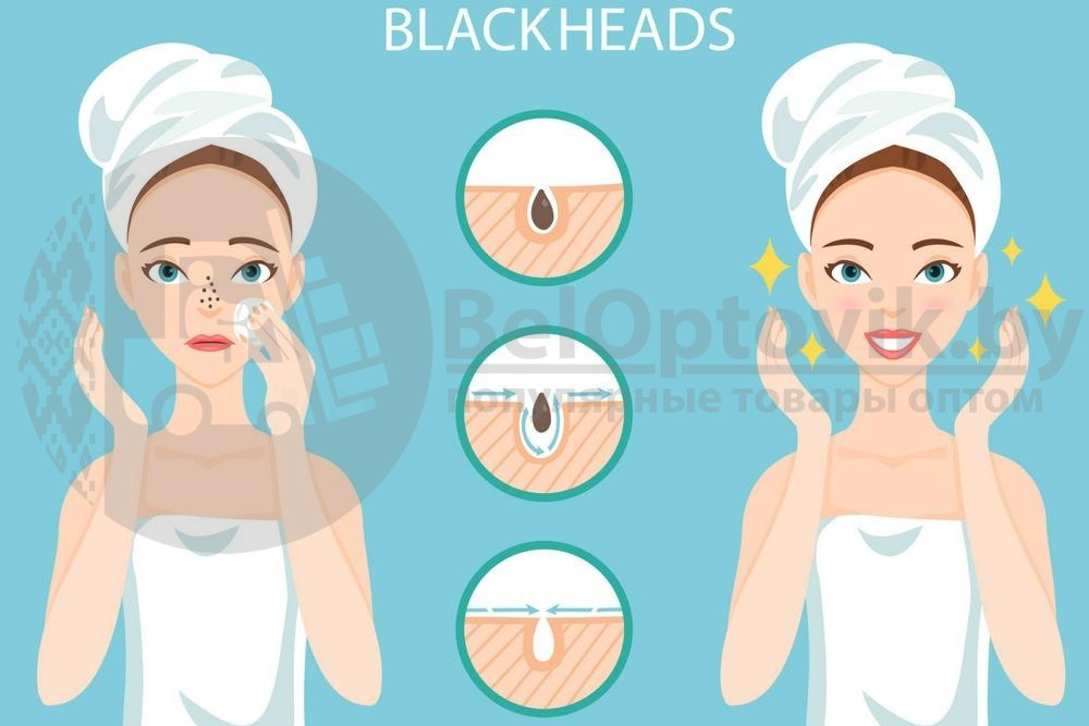 Маска для очистки пор трехэтапная BIOAQUA Remove Black Heads 3-step Kit Gray - фото 9 - id-p94455957