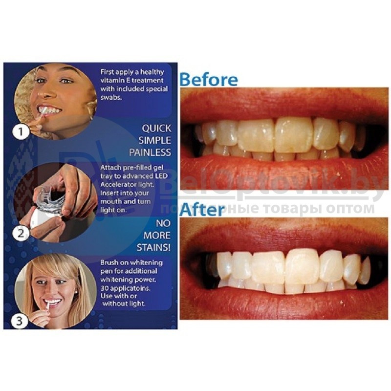 Средство для отбеливания зубов 20 Minute Dental White. NEW - фото 6 - id-p95371248