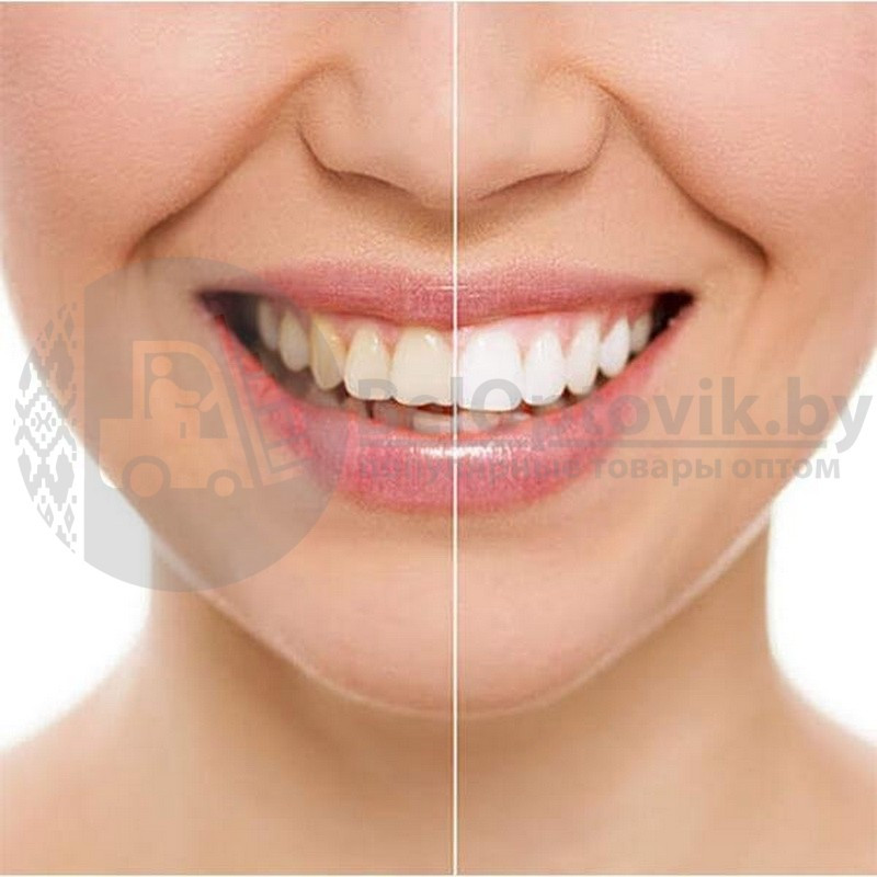 Средство для отбеливания зубов 20 Minute Dental White. NEW - фото 8 - id-p95371248