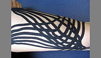 КАК KINESIO ТЕЙПИРОВАНИЕ ПОМОГАЕТ ПРИ СИЛЬНЫХ ОТЕКАХ