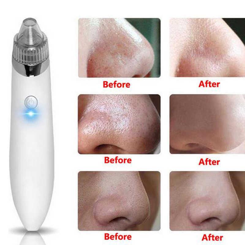 Вакуумный очиститель пор кожи лица Beauty Skin Care Specialist XN-8030 (2 модели) - фото 3 - id-p91275424