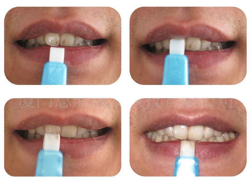 Средство для отбеливания зубов Teeth Cleaning Kit - фото 2 - id-p98875620