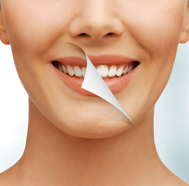 Высокоэффективное комплексное отбеливание зубов 