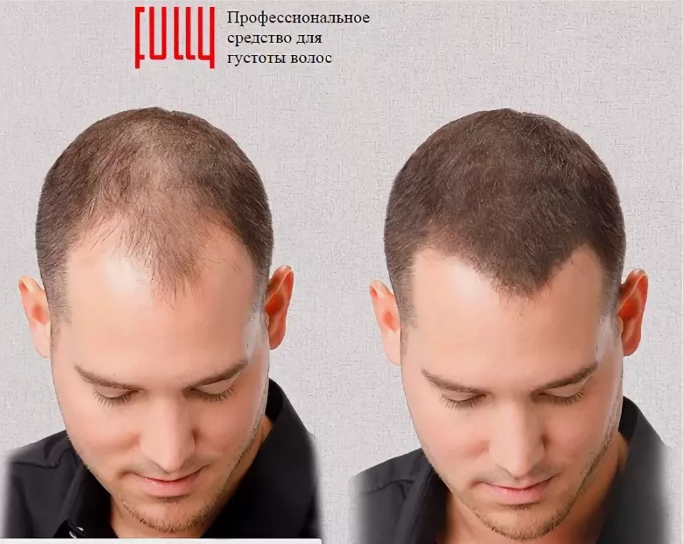 Средство Fully Hair по увеличению объема волос на голове и бороде, маскировка залысин - фото 2 - id-p103388761