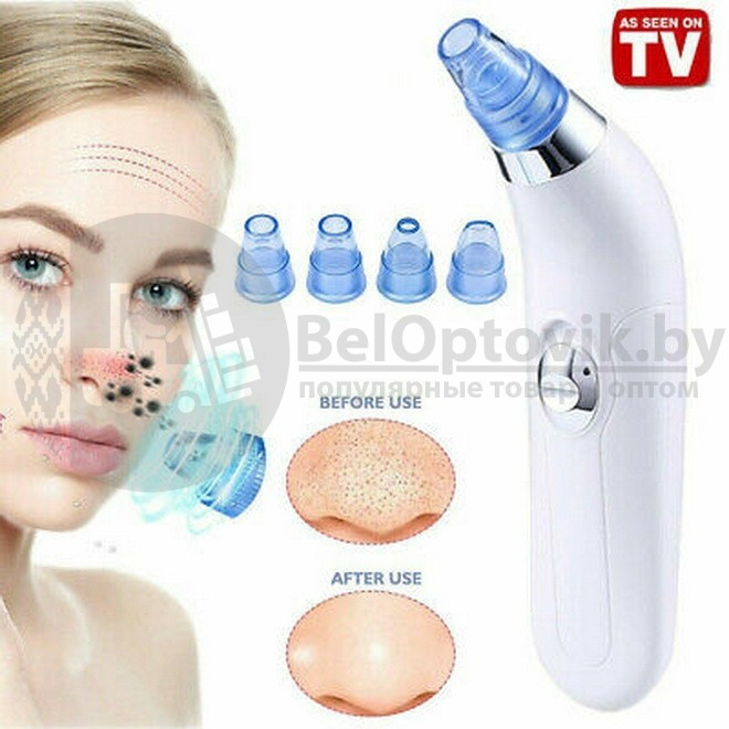 Устройство для очистки пор DermaSuction (Вакуумный очиститель пор) - фото 6 - id-p104501606