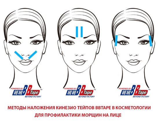 Кинезио тейп Kinesiology Tape - фото 8 - id-p105439398