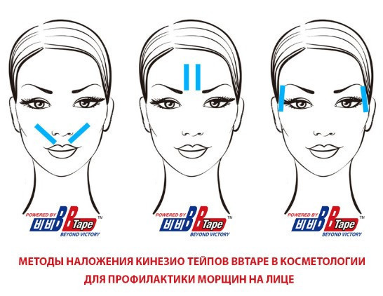 Кинезио тейп Kinesiology Tape (Китай) упаковка 5 м - фото 9 - id-p105454706