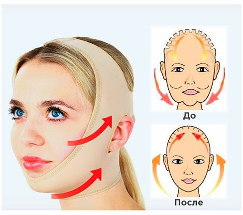 Маска-бандаж для коррекции овала лица и от второго подбородка - фото 2 - id-p70125157