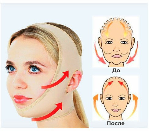 Бандаж для лица до и после
