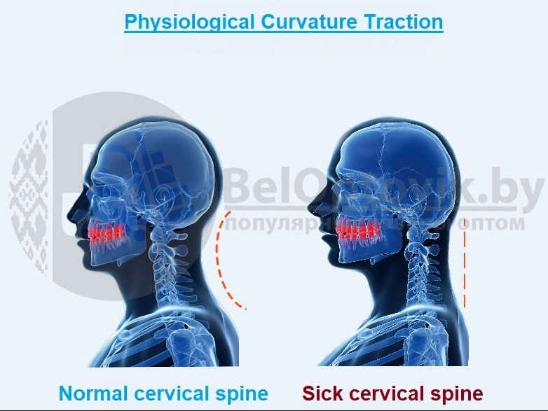 Тренажер для коррекции шейного отдела позвоночника Cervical Vertebrae Physiotherapy Instrument - фото 2 - id-p109388943