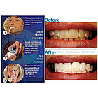 Средство для отбеливания зубов 20 Minute Dental White. NEW, фото 6