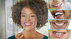 Средство для отбеливания зубов SONIC PIC Gentle at Home Dental Cleaning System, фото 3