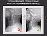 Тренажер для коррекции шейного отдела позвоночника Cervical Vertebrae Physiotherapy Instrument, фото 5