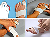 Ортопедический корсет Hallufix Hallux Valgus Schiene. Шарнирная Шина от косточки большого пальца сто, фото 5