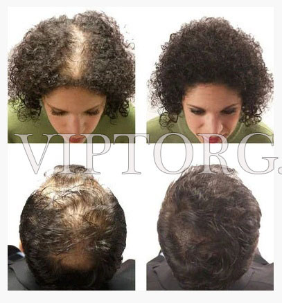 Уплотнитель структуры волос Загуститель для волос Fully Hair - фото 9 - id-p52494402