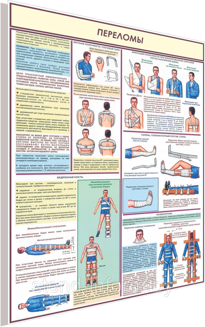 Плакат по охране труда  Переломы  №8д  р-р 40*57 см на ПВХ