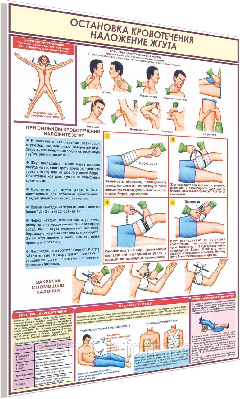 Плакат по охране труда Остановка кровотечения №8е р-р 40*57 см на ПВХ - фото 1 - id-p126269862