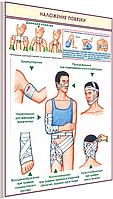 Плакат по охране труда  Наложение повязки  №8з  р-р 40*57 см на ПВХ 3 мм