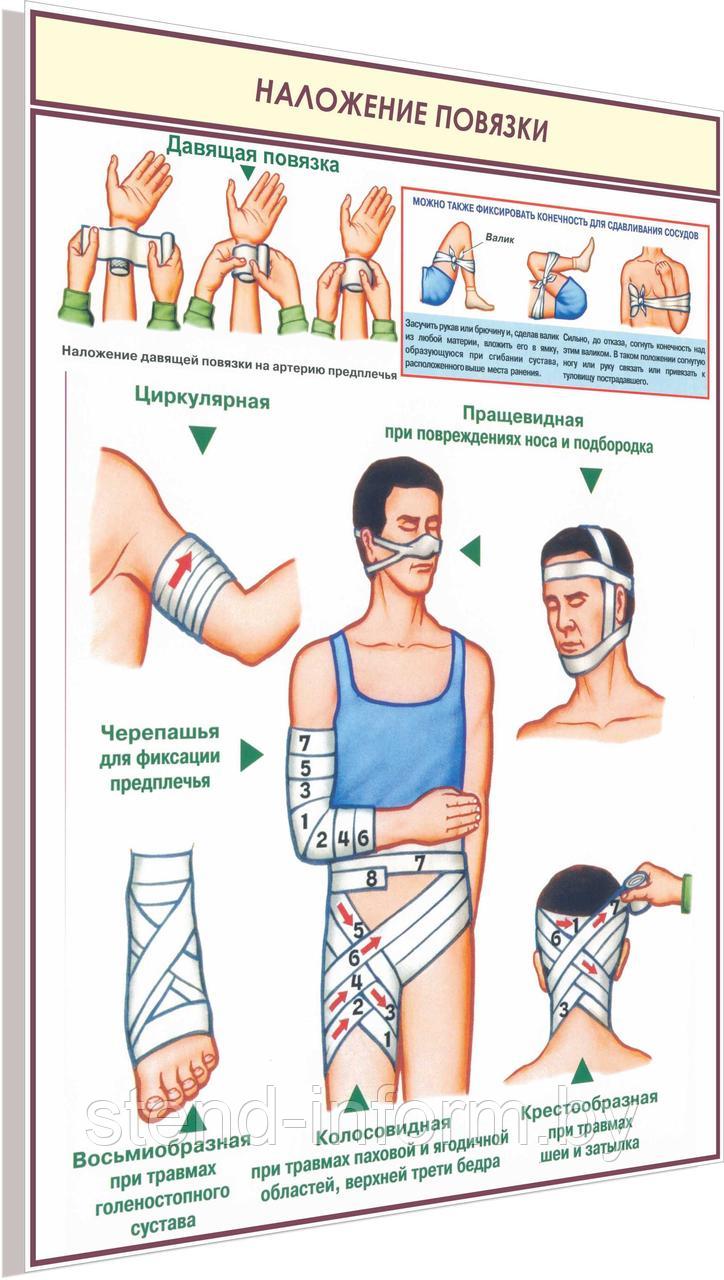 Плакат по охране труда Наложение повязки №8з р-р 40*57 см на ПВХ 3 мм - фото 1 - id-p126282525