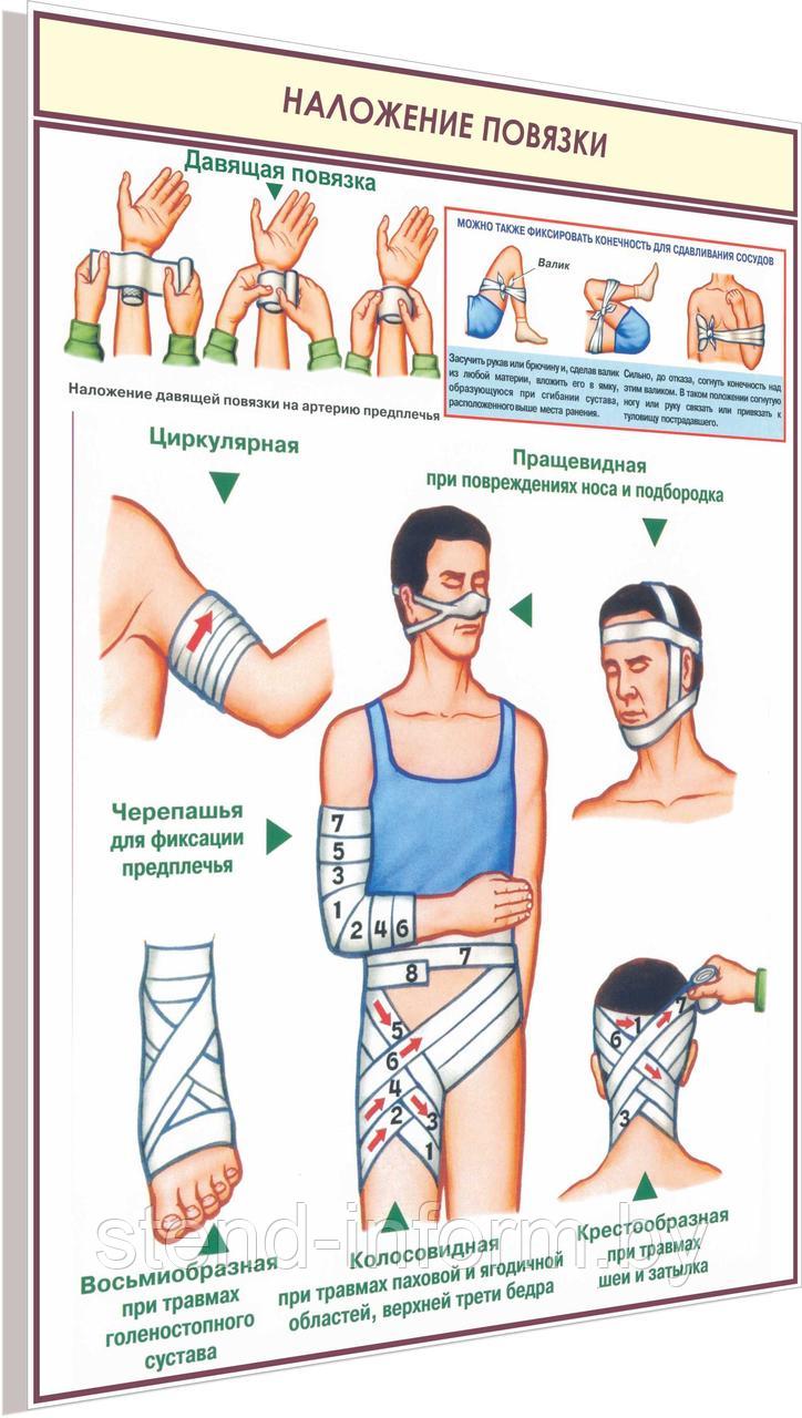 ПЛАКАТ по Охране труда "Наложение повязки" №8з р-р 40*57 см на ПВХ
