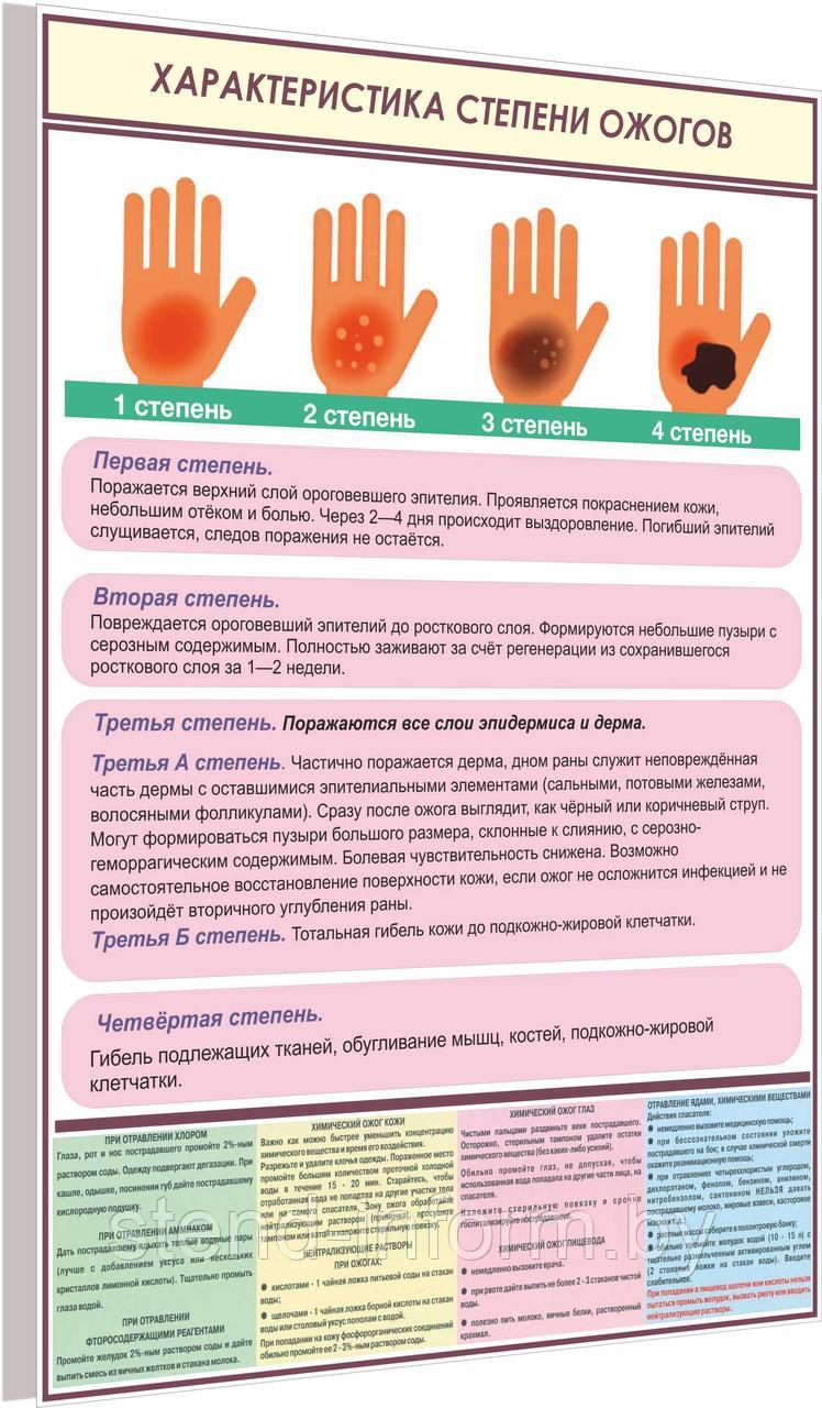 Плакат по охране труда  Характеристика степени ожогов  №8и  р-р 40*57 см на ПВХ