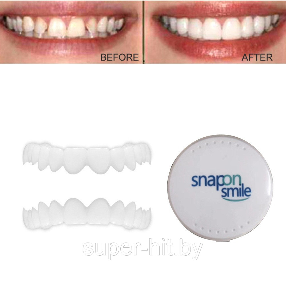Набор для ВЕРХНИХ и НИЖНИХ зубов. Накладные зубы Snap on Smile - фото 2 - id-p129003700