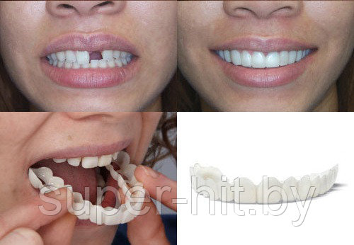 Набор для ВЕРХНИХ и НИЖНИХ зубов. Накладные зубы Snap on Smile - фото 9 - id-p129003700