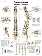 Плакат "Позвоночник, анатомия и патология"