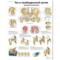 Плакат "Таз и тазобедренный сустав, анатомия и патология"