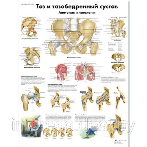 Плакат "Таз и тазобедренный сустав, анатомия и патология" - фото 1 - id-p131055303