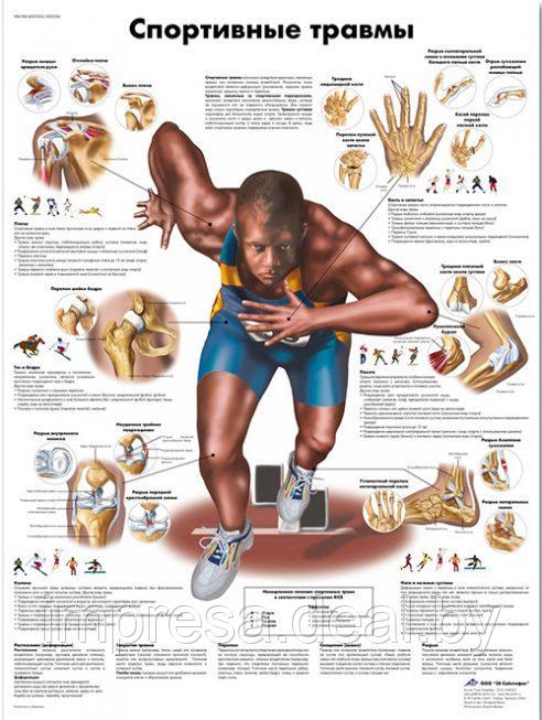 Плакат "Спортивные травмы" - фото 1 - id-p131055307