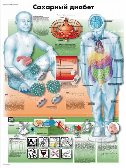 Плакат "Сахарный диабет" - фото 1 - id-p131055329