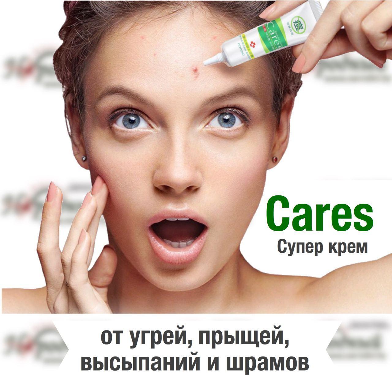 Супер Крем CARES (от угрей, прыщей, высыпаний и шрамов)