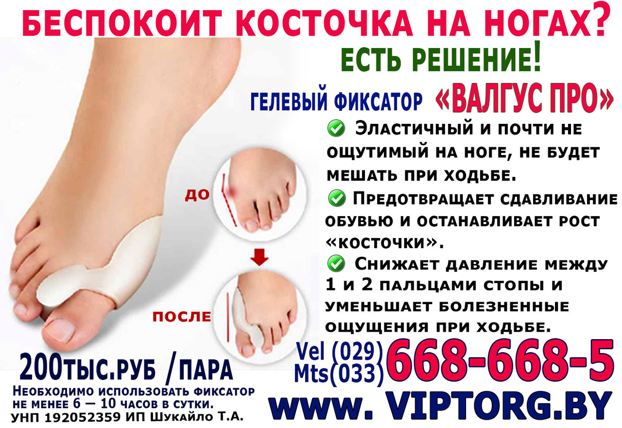 Силиконовый фиксатор от косточки на ноге Valgus Pro . Фиксатор большого пальца 2 штуки - фото 4 - id-p81121097