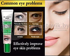 Профессиональный гель для увлажнения кожи вокруг глаз с экстрактом Aloe Vera Wrinkle Erasing Gel 92 Natural, фото 2
