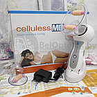 Вакуумный антицеллюлитный массажер Celluless MD (Целлулес МД)  220 V, фото 6
