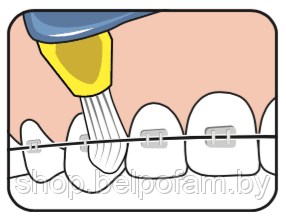 Зубная щетка ТеРе Interspace (средней степени жесткости), 12 сменных насадок - фото 5 - id-p141909773