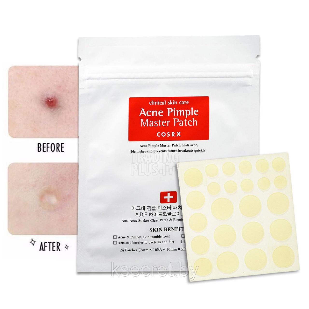 КСР Патчи от акне противовоспалительные [COSRX] Acne Pimple Master Patch - фото 2 - id-p145470800