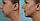 Тренажёр для подтяжки овала лица скул, челюсти, шеи, линии подбородка, фото 4